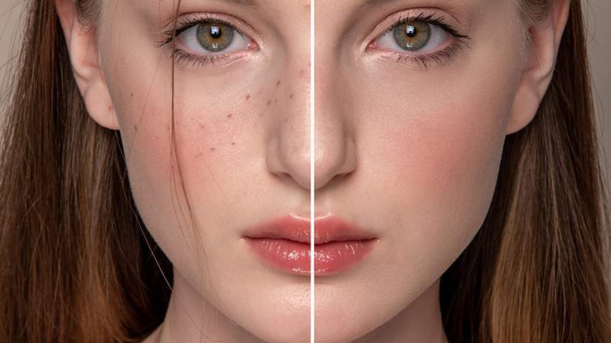 High End Skin Retouching in Photoshop web 860
